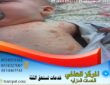حشرة البق